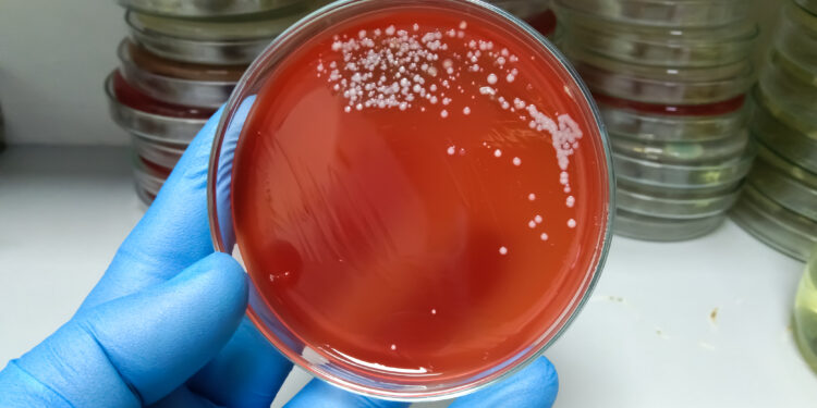 Alerta por brote de estreptococo en Chile: Bacteria Asesina