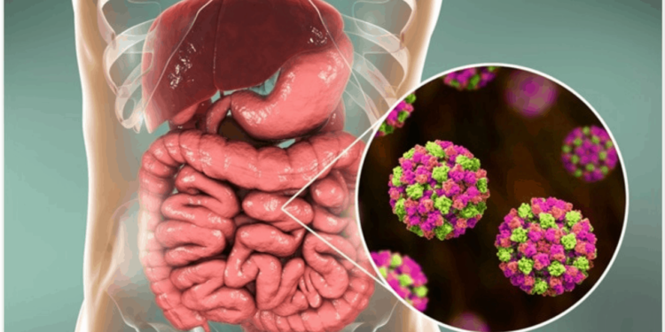 Alerta por el “virus del vómito”: expertos llaman a extremar medidas de higiene